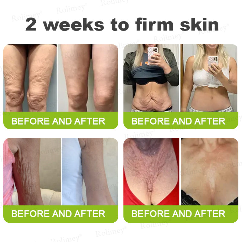 🌹Made and shipped from the CA 💫Rolimey® Botox & Vita-A Retinol Shot Wrinkle-Lift Tightening cream - Last Day Promotion 70% OFF