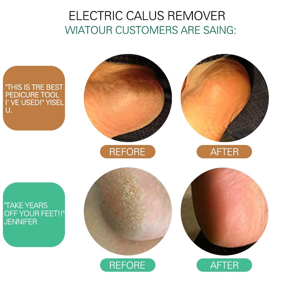 Electric Callus Remover (Speed Adjustable)
