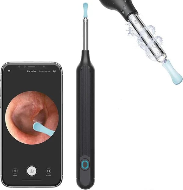 1080P Ear Wax Removal Camera(BUY 2 GET FREE SHIPPING)