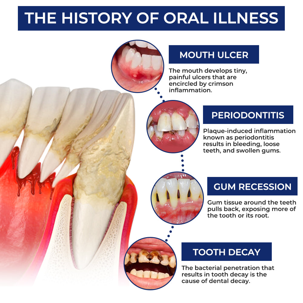 Rolimey® BeeTakt Bee Venom Dental Treatment Drops Mouthwash